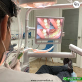 #0171 KIT MULTIMEDIA- CAMARA INTRAORAL CON MONITOR 17´´