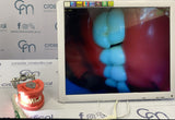 #0171 KIT MULTIMEDIA- CAMARA INTRAORAL CON MONITOR 17´´
