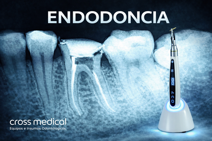 ENDODONCIA